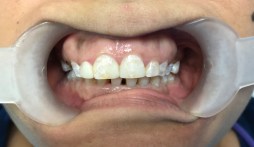 FullSizeRender.jpg-1